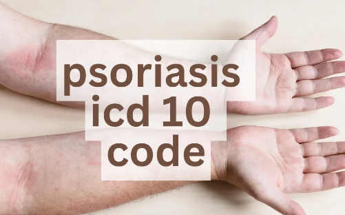 Icd 10 Code for Arthritis